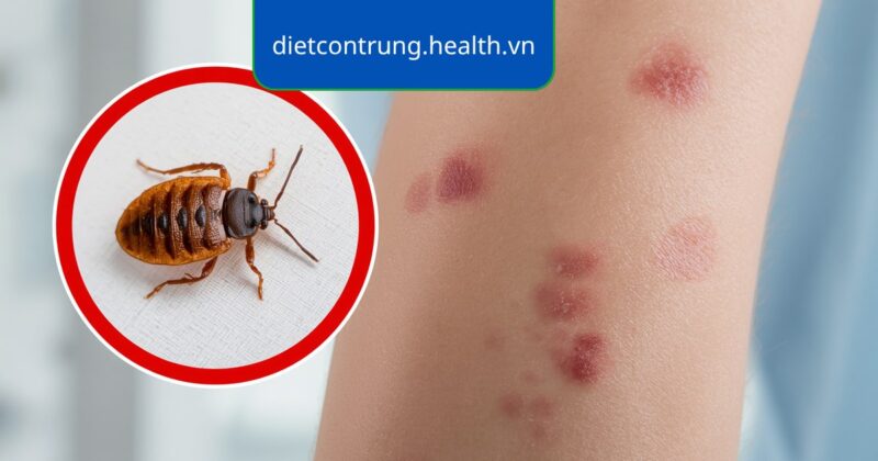 Người kiểm tra da cánh tay trong phòng ngủ, minh họa nhận biết vết rệp cắn